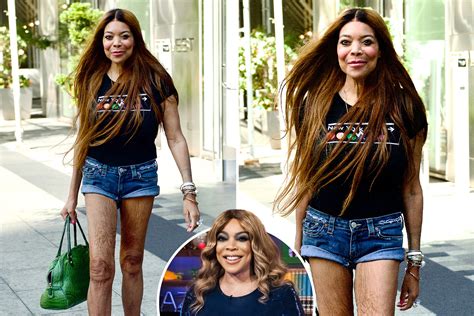 wendy williams condition today